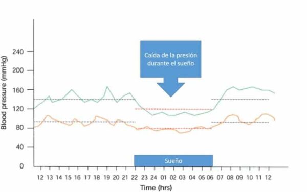 MApa Presion Arterial