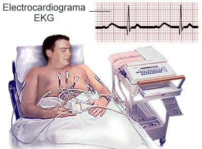 Electrocardiograma en reposo durante la Valoración pre anestesica